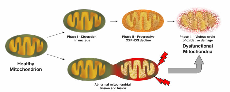 mitochondrial dysfunction